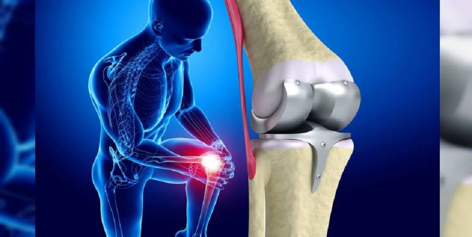 Knee Replacement Surgery For Accute Knee Pain