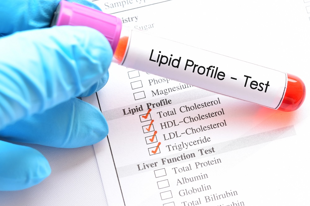 Lipid Profile Test: What Should You Know About It? 