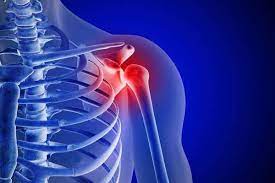 Are You Suffering From Sports Injury? Need Shoulder Sports Injury Treatment in Delhi 