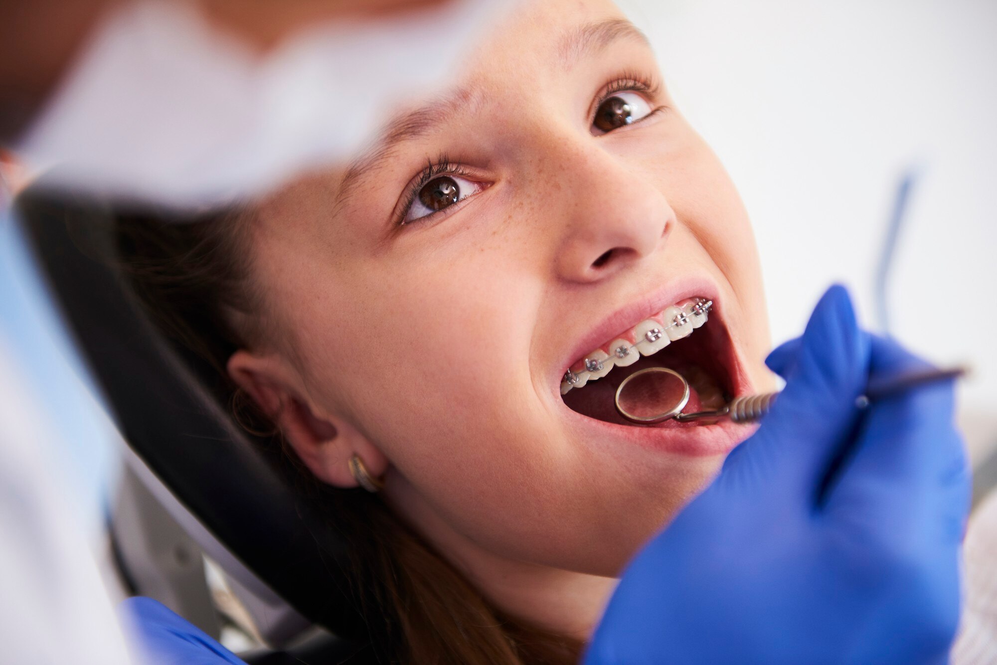 Common Signs Your Child Might Need Orthodontic Attention