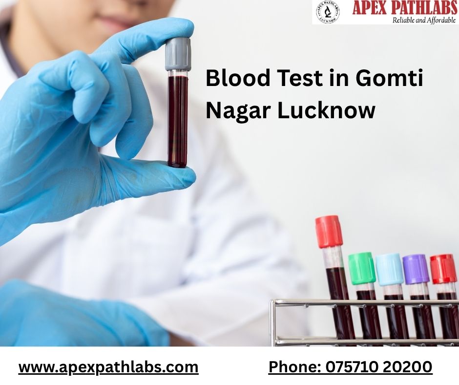 What Does Your CBC Report Really Say About Your Health?