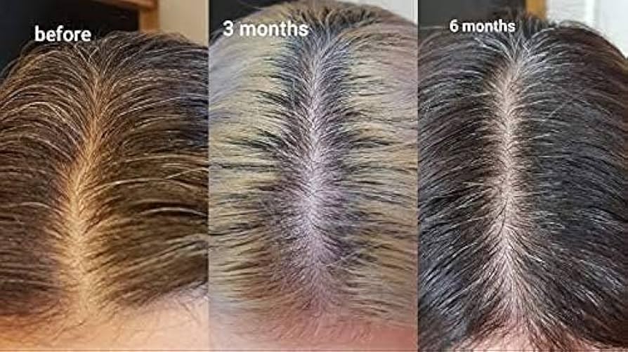 Boosting Hair Growth Naturally with Multi-Peptide Hair Density Solutions