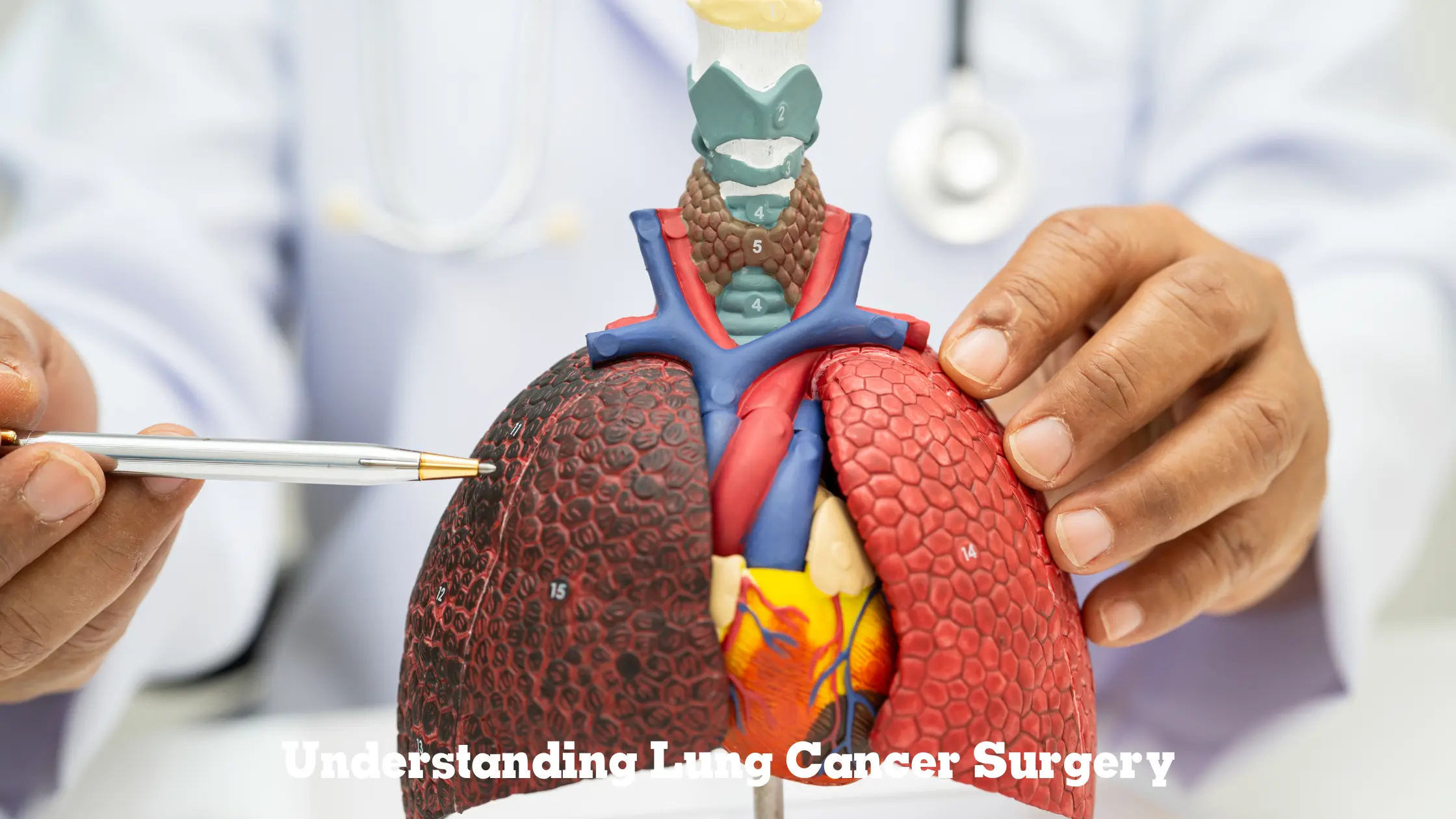 Lung Cancer Surgery: Treatment Options & Recovery Guide