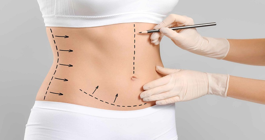 Is Liposuction a Safe Option for Weight Loss in Islamabad?