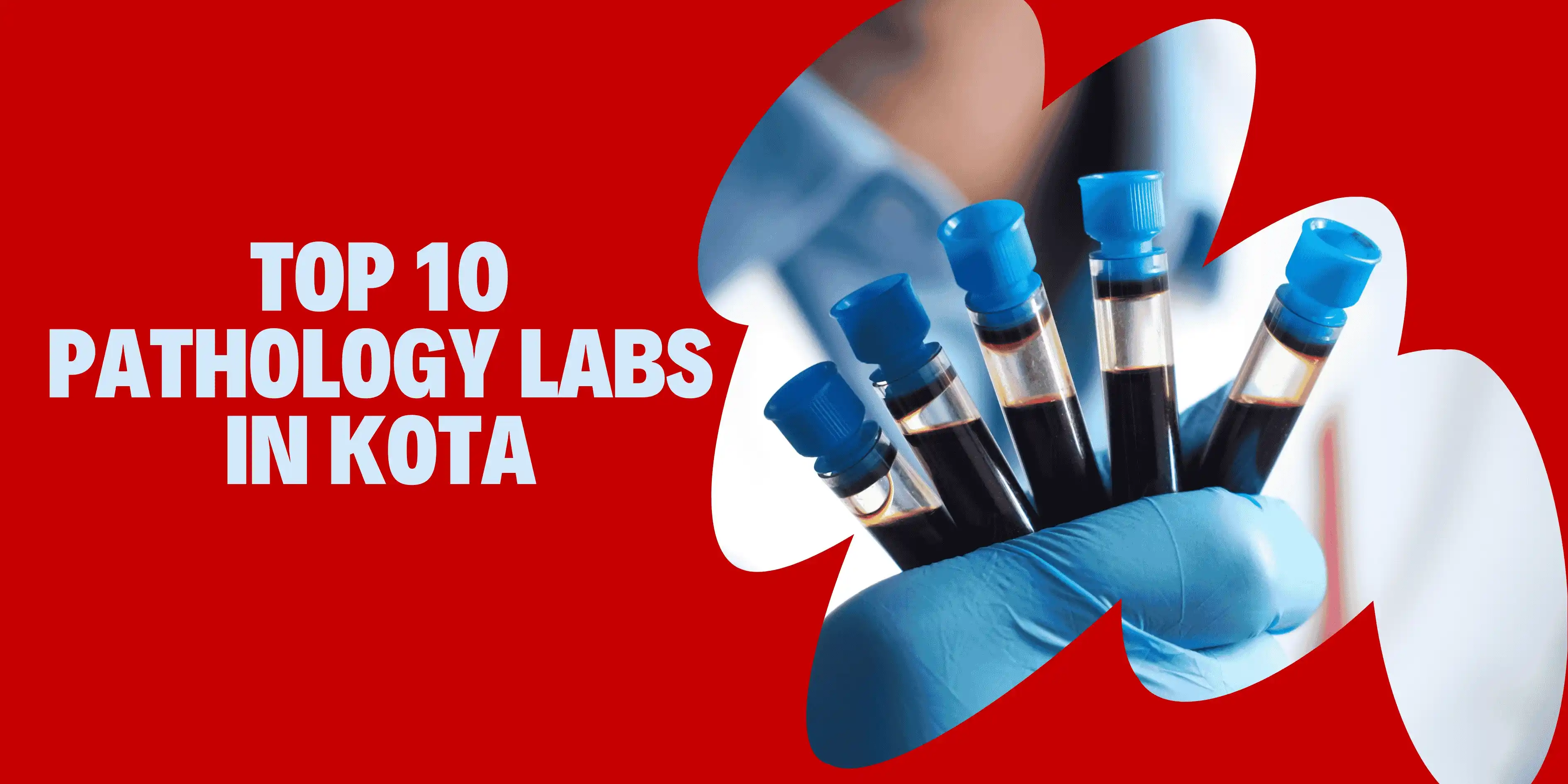 Top 10 Pathology Labs in Kota