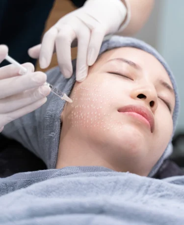 7 POWERFUL REASONS MESOTHERAPY DUBAI IS TRENDING FOR NATURAL RESULTS
