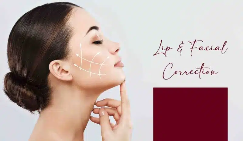 Best Lip Lengthening Treatment in Hyderabad | Trusted Experts at FMS Dental