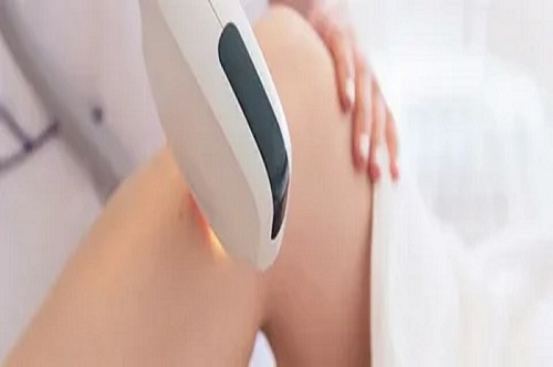 How Laser Hair Removal Treatment Delivers Long Lasting Smoothness