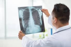Digital Diagnostics Made Easy: Your Complete Guide to Modern X-Ray Services by Ecotown