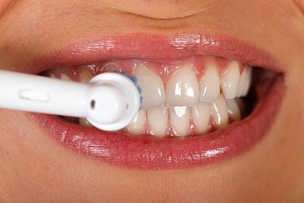 How Teeth Scaling and Polishing Help You Achieve Better Oral Hygiene