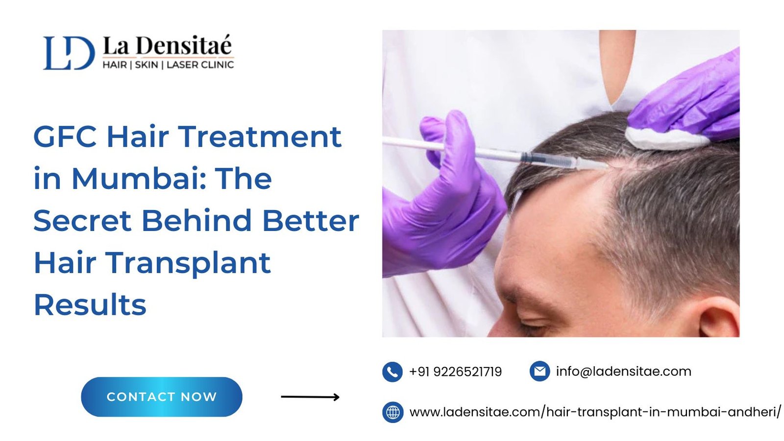 GFC Hair Treatment in Mumbai: The Secret Behind Better Hair Transplant Results