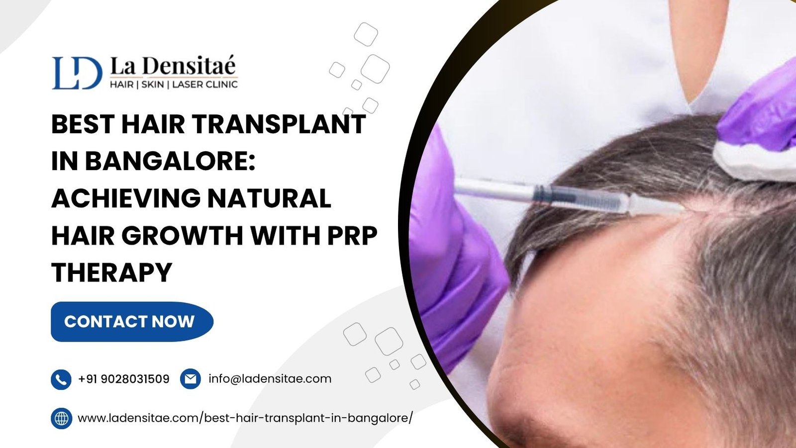 Best Hair Transplant in Bangalore: Achieving Natural Hair Growth with PRP Therapy