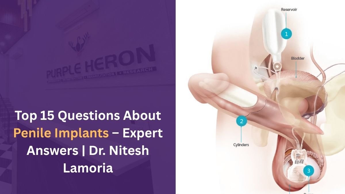 Top 15 Questions About Penile Implants – Expert Answers