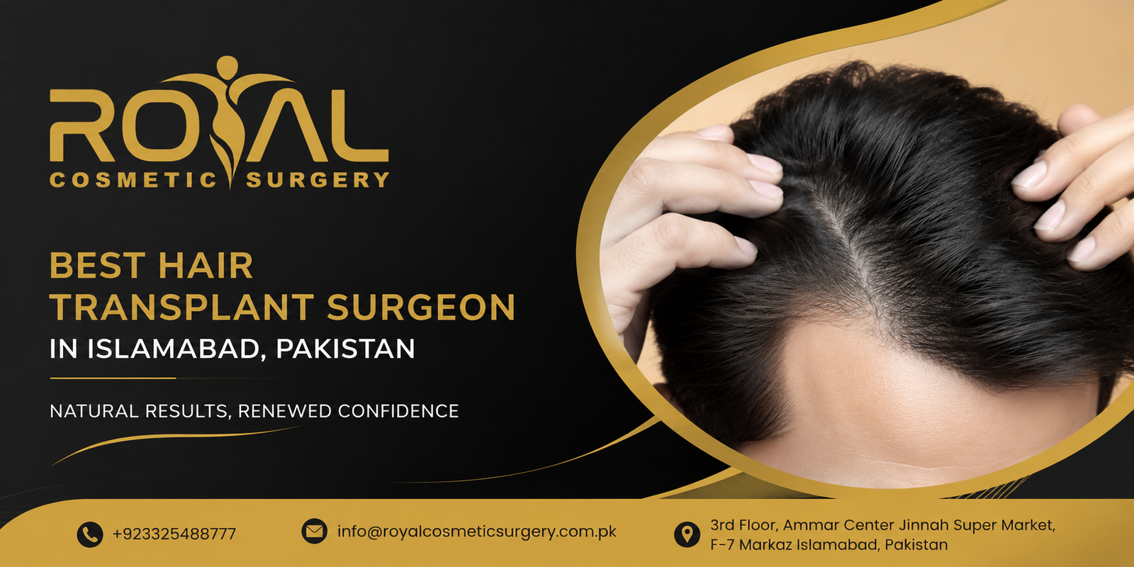 How the Best Hair Transplant Surgeon Ensures Patient Satisfaction