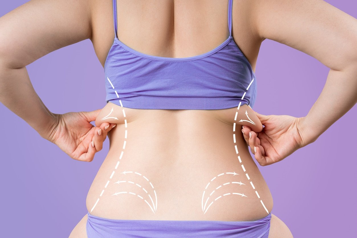 Patient-Focused Clinics for Vaser 4D Liposuction in Dubai