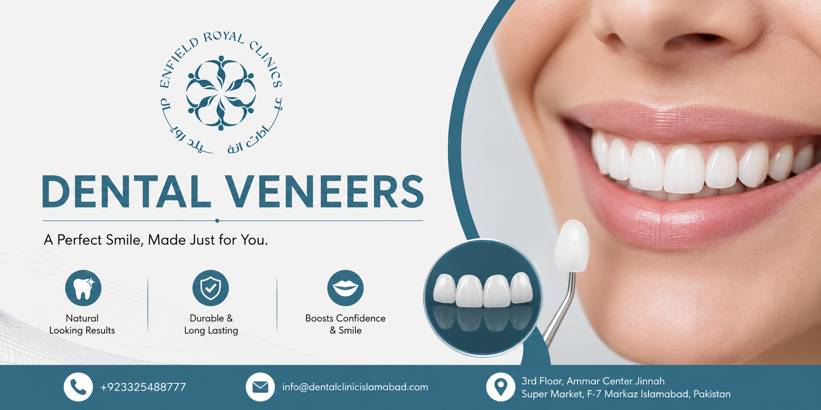 Affordable Dental Veneers in Islamabad for Every Budget