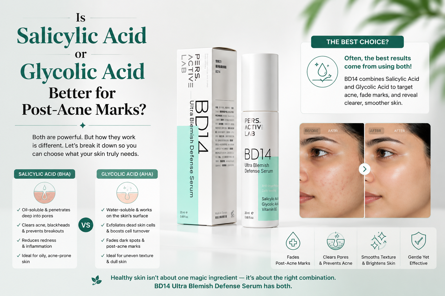 Is Salicylic Acid or Glycolic Acid Better for Post-Acne Marks?