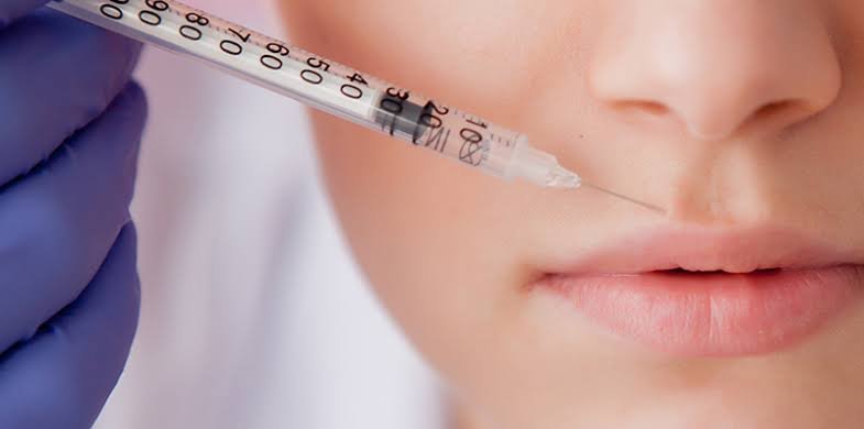 Botox Lip Flip vs Lip Implants: Comparison Guide