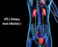 UTI Dyer and Drinking Water Benefits