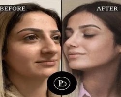 Explore the Best Aesthetic Clinics in Dubai for Advanced Beauty Solutions