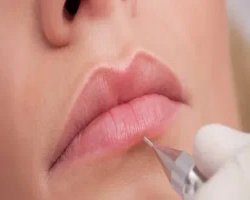  Enhance Your Natural Beauty with Lip Fillers in Plano, Texas