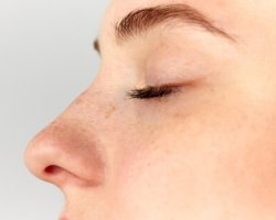 Is Rhinoplasty in Islamabad Painful? Separating Truth from Fear