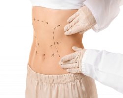 Tummy Tuck in Dubai: How to Prepare for Your Procedure