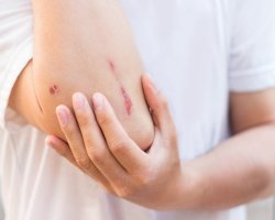 Expert ER Urgent Care for Wound Care Services