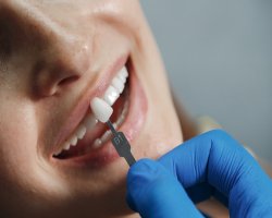 Why Dental Crowns Are a Trusted Solution for Damaged Teeth