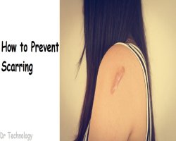 Top Home Remedies for Cuts & Scrapes That Really Work