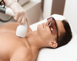 What Does Evo Laser Treatment Involve For Patients?