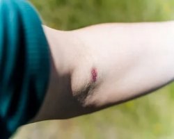 Walk-In Minor Injuries Clinic in Sterling Heights Near You