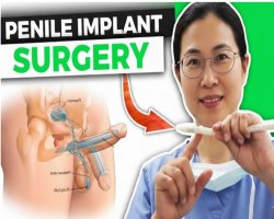 Penile Implant Surgery: The Ultimate Detailed Medical and Patient Guide
