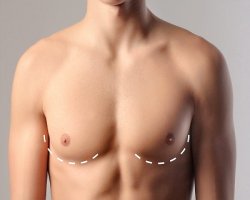 Discover Safe and Effective Gynecomastia Surgery Solutions in Riyadh