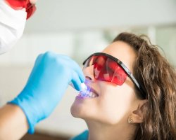 Professional Teeth Whitening in Uttam Nagar | Dentohub