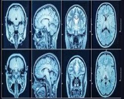 CT Scan Cost in Bangalore: A Complete Guide by Ecotown