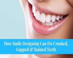 How Smile Designing Can Fix Crooked, Gapped & Stained Teeth