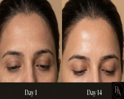 The Skin Glow Treatment Korean Dermatologists Made Famous — Now in Islamabad