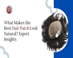 What Makes the Best Hair Patch Look Natural? Expert Insights