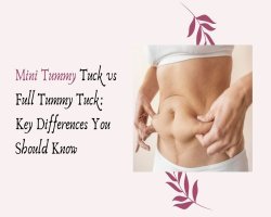 Mini Tummy Tuck vs Full Tummy Tuck: Key Differences You Should Know