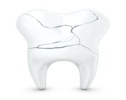 Tooth Fracture Treatment in Pakistan: Dental Care Standards, Safety, and Modern Practices