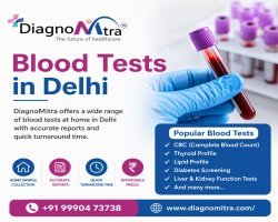 Blood Tests in Delhi | Home Sample Collection