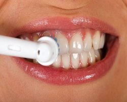 How Teeth Scaling and Polishing Help You Achieve Better Oral Hygiene