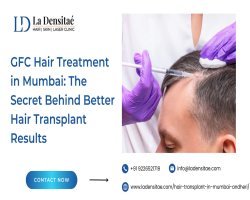 GFC Hair Treatment in Mumbai: The Secret Behind Better Hair Transplant Results