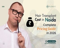 Hair Transplant Cost in Noida: What You Should Actually Know Before Spending a Rupee