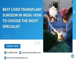 How to Choose the Best Liver Transplant Surgeon in India for Successful Treatment