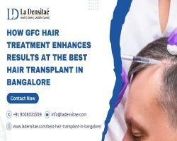 How GFC Hair Treatment Enhances Results at the Best Hair Transplant in Bangalore