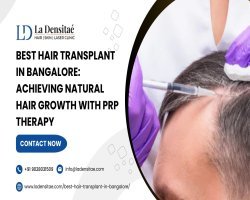 Best Hair Transplant in Bangalore: Achieving Natural Hair Growth with PRP Therapy