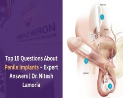 Top 15 Questions About Penile Implants – Expert Answers