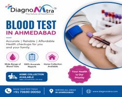  Blood Test in Ahmedabad | Book Lab Test at Home